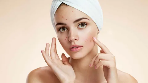 Effective Natural Products for Treating Acne Scars